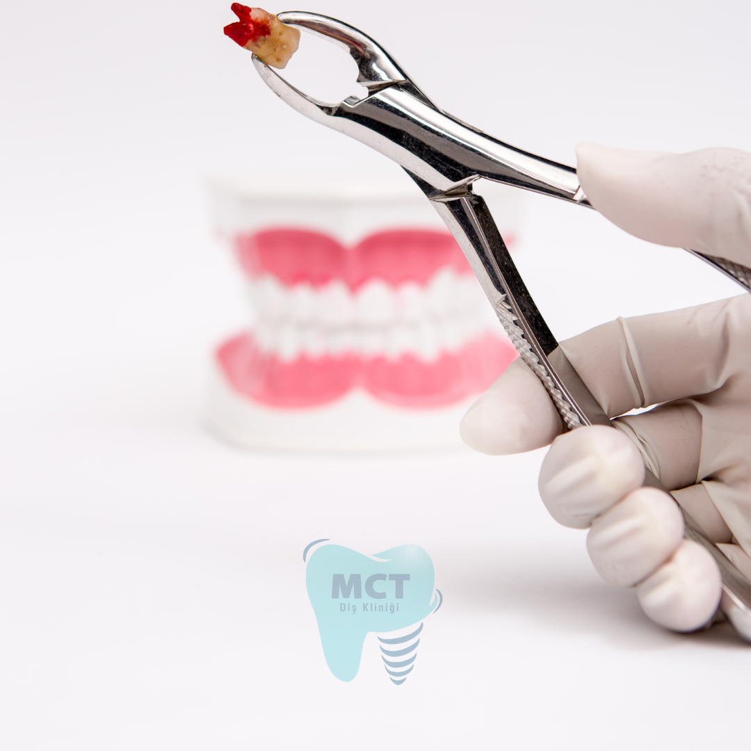 MCT-agiz-dis-istanbul-bagcilar-gunesli-gungoren-mahmutbey-yenibosna-zeytinburnu-Avcilar-Esenler-Mecidiyrkoy-bahcelievler-silirnevler-d,s-poliklinigi-implant-kanal-tedavisi-cekim-kucuk-cekmeke-buyuk-cekmece-esenyurt-esenkent-besiktas-nöbetçi dişçi -acil dişçi -bağcılar acil diş -güneşli acil diş -