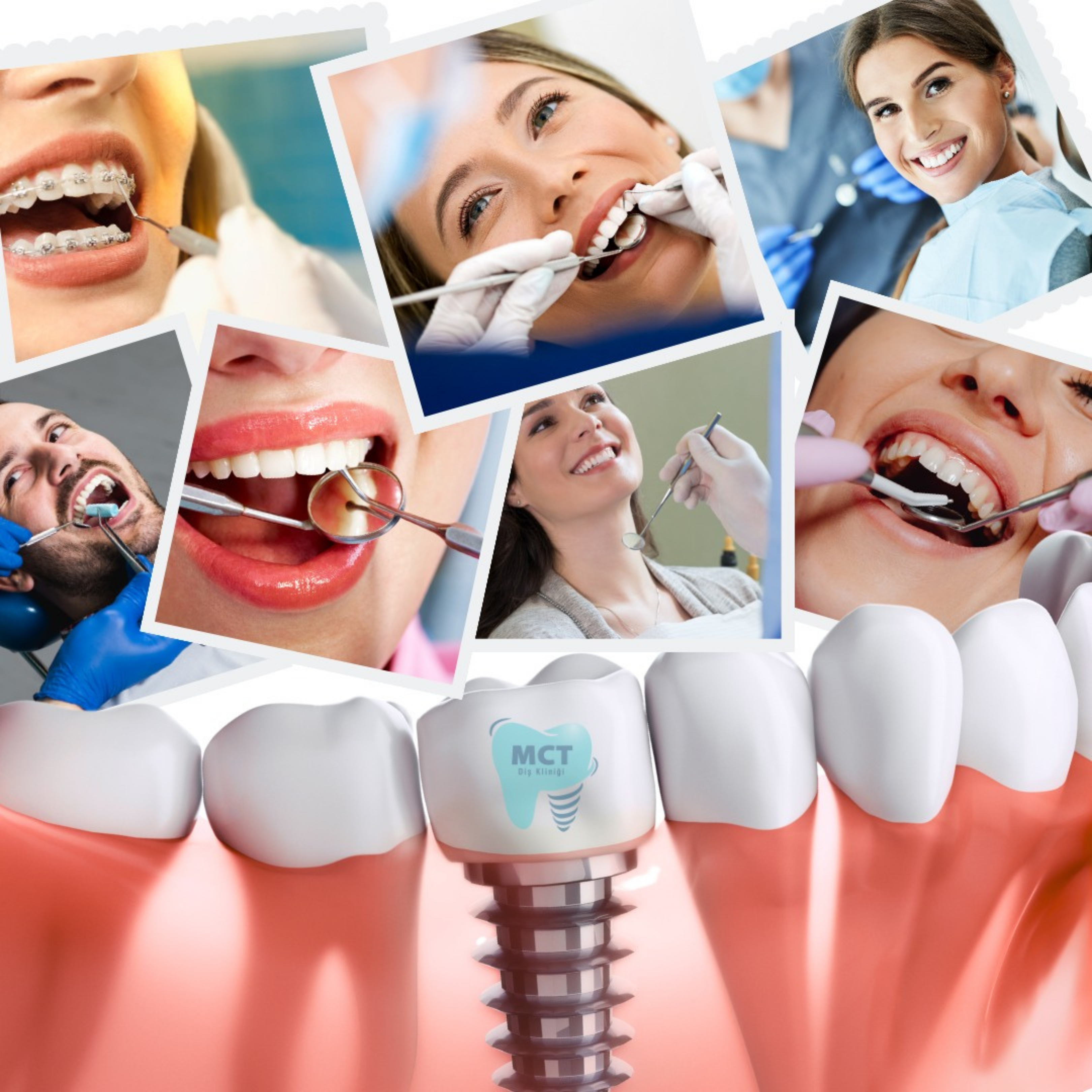 MCT-agiz-dis-istanbul-bagcilar-gunesli-gungoren-mahmutbey-yenibosna-zeytinburnu-Avcilar-Esenler-Mecidiyrkoy-bahcelievler-silirnevler-d,s-poliklinigi-implant-kanal-tedavisi-cekim-kucuk-cekmeke-buyuk-cekmece-esenyurt-esenkent-besiktas-nöbetçi dişçi -acil dişçi -bağcılar acil diş -güneşli acil diş -